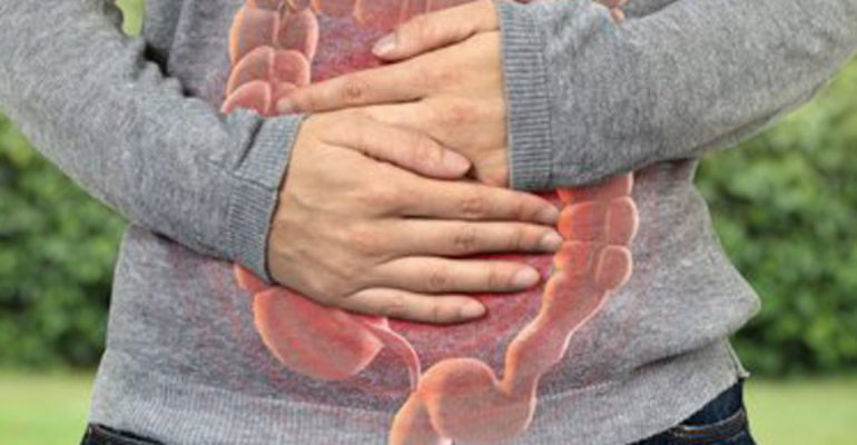 La Botika 148 | Enfermedad inflamatoria intestinal